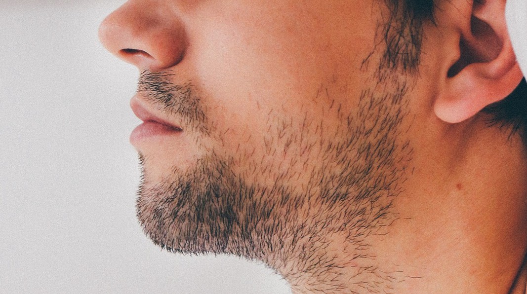 Problèmes courants pour une barbe